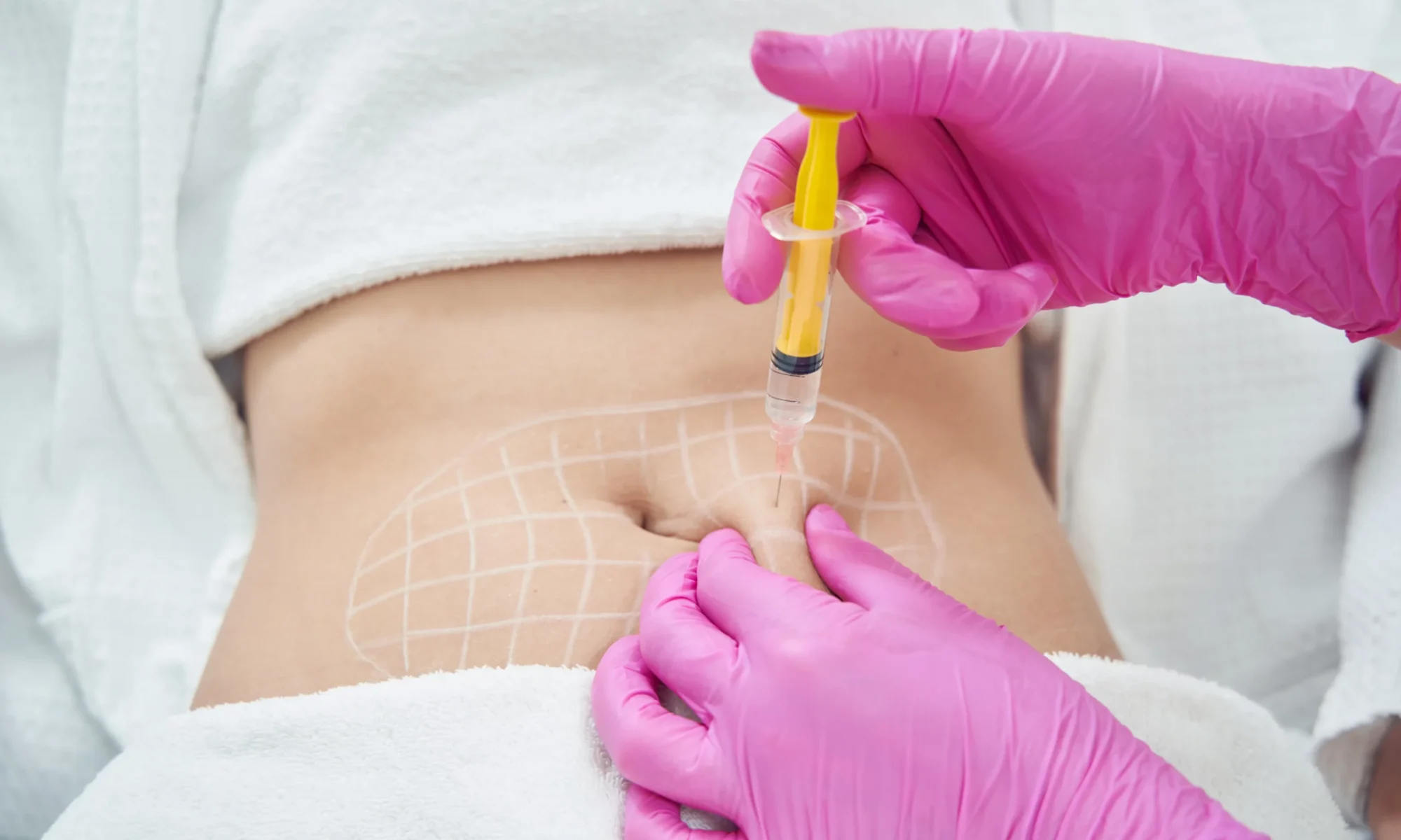 Lipo Dissolve | River Oaks Skin Institute Houston Tx